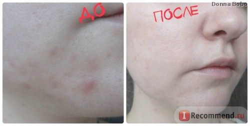 Крем для лица Ducray keracnyl pp acne-prone skin фото