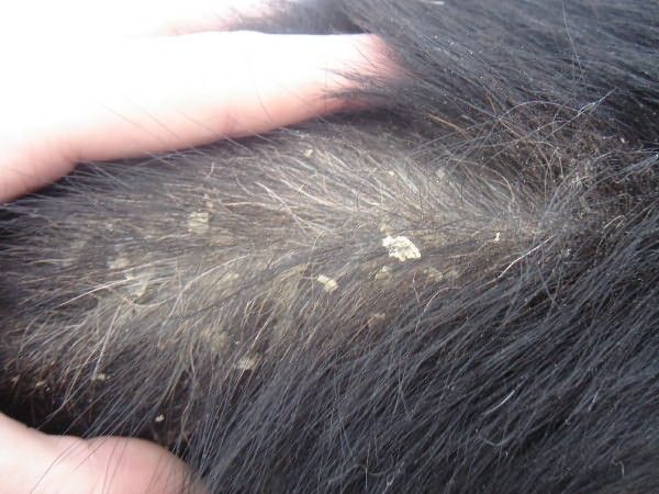 Основная причина перхоти – грибковые заболевания кожи