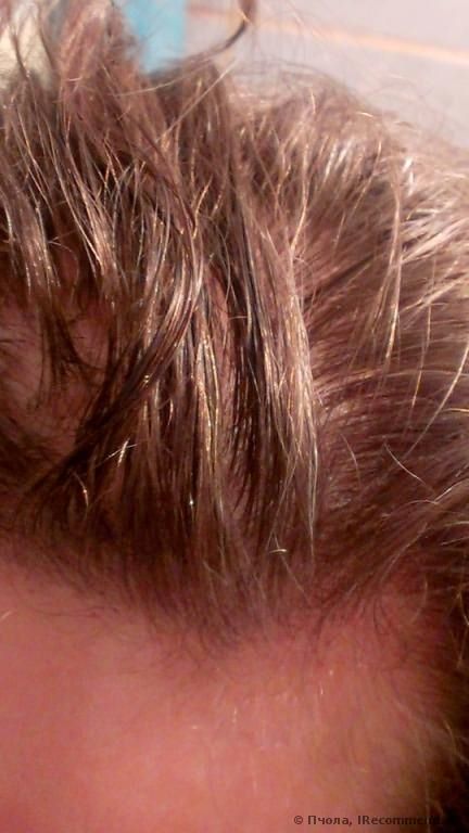 Средство от выпадения волос Атлас-1 «Эсвицин» фото