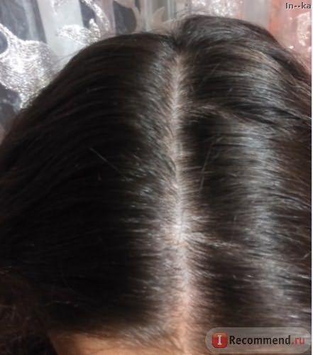 Мезотерапия волос и головы фото