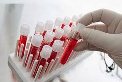На ранней стадии анемия определяется только по анализу крови