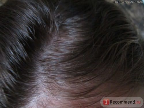 Шампунь CLEAR VITA ABE WOMEN Защита от выпадения волос фото
