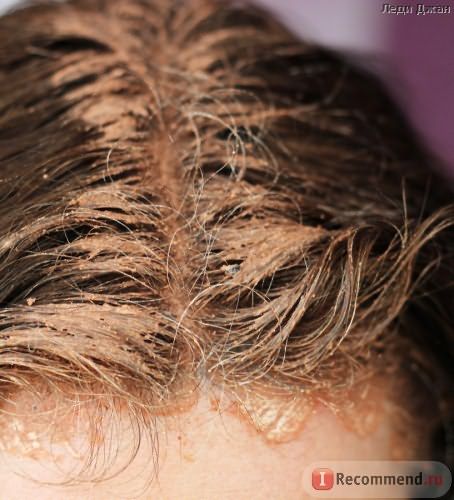 Маска для волос DNC С красным перцем от выпадения волос фото