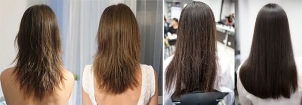 Волосы до и после лечения