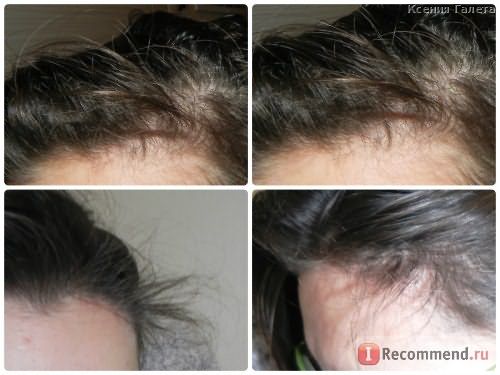 Эссенция для роста волос Andrea Hair Growth Essence фото