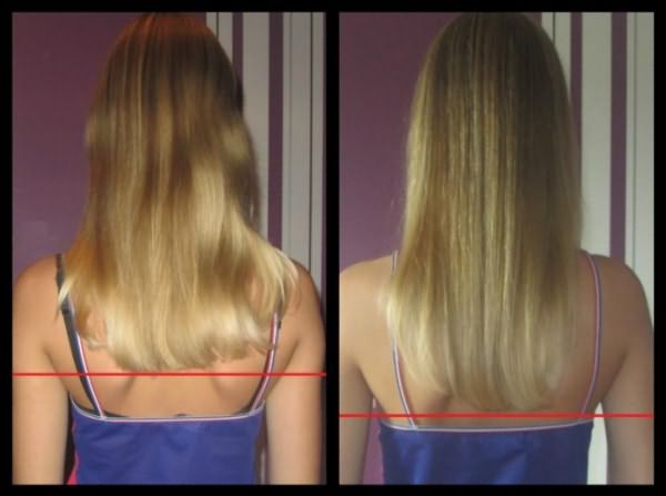 Рост волос после приема препарата: до и после 