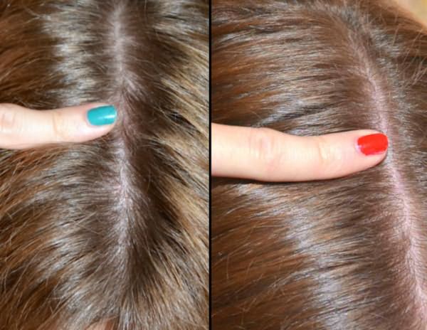 Улучшение состояния волос после приема Доппельгерц: до и после