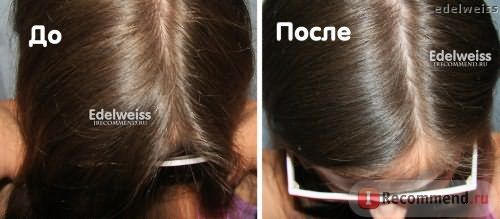Шампунь от перхоти Head&Shoulders против выпадения волос фото